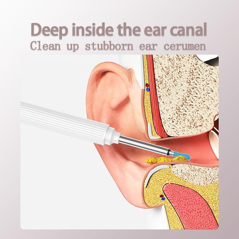 gukoo 10mp HD Ear Cleaner with Camera and LED Light, 2026 New 2-in-1 Ear Wax Removal Camera, with Precision Tweezers & Silicone Scoop, Earwax with Ease, IP67 Waterproof Lens, Wireless & Easy to Use (Black)
