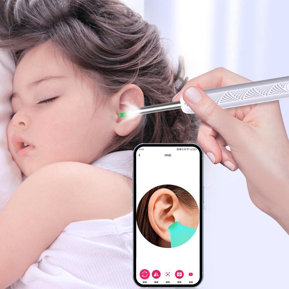 Kribee Ear Wax Removal with Camera, Smart Visual Earwax Cleaning Tool with 6 LED Lights, Earwax Remover Tool, Ear Cleaner Ear Wax Removal Kit